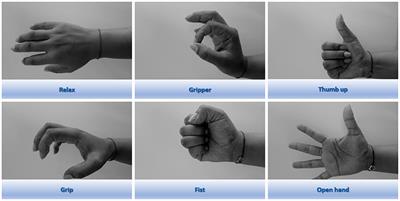 sEMG-Based Gesture Classifier for a Rehabilitation Glove